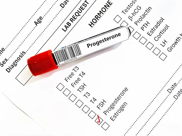 Serum Progesterone Test Overview