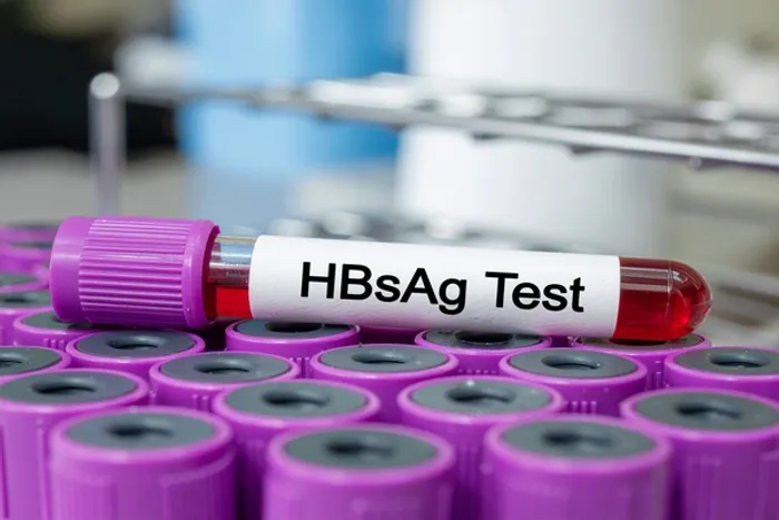 hbsag test