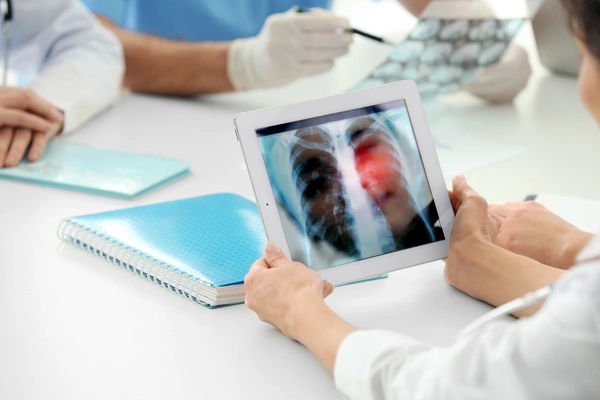 lung cancer