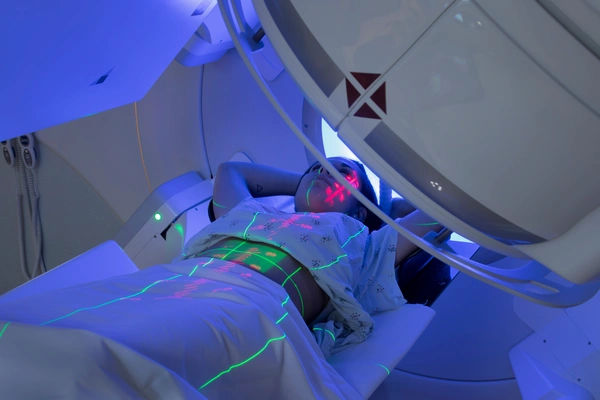 radiation therapy