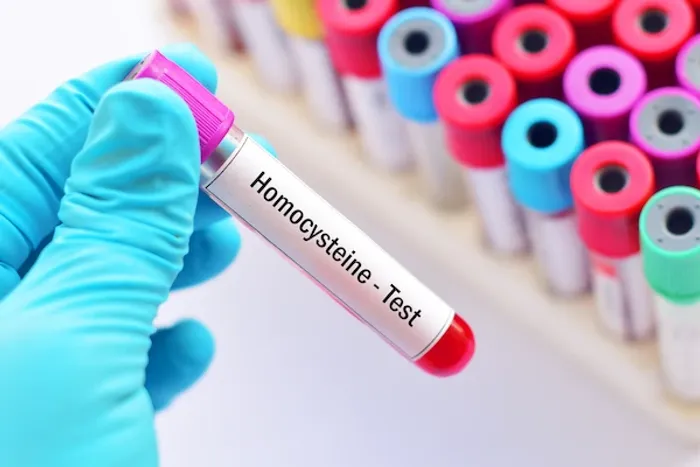 homocysteine