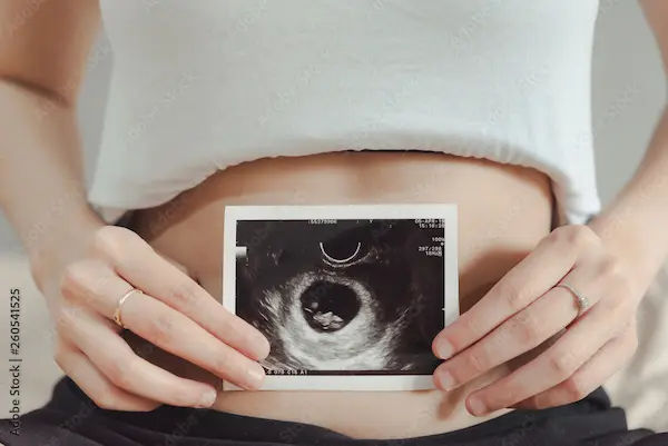 7 Weeks Pregnant