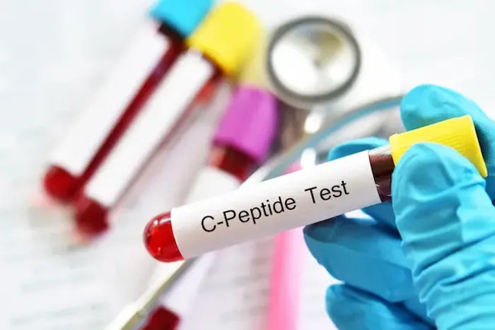 C Peptide Test