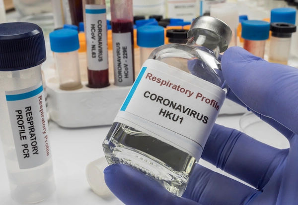What Leads To Signs Of Human Coronavirus HKU1? Causes & Symptoms Explained