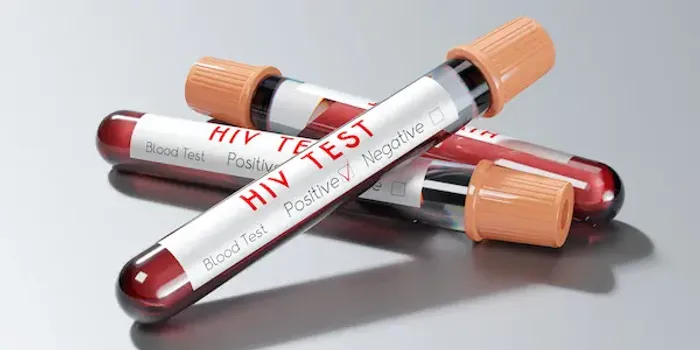 Hiv And Aids