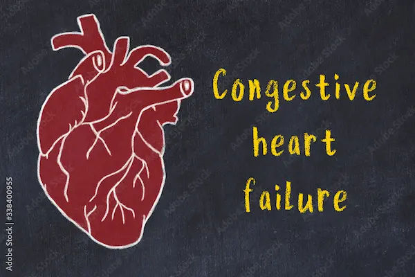 Congestive Heart Failure
