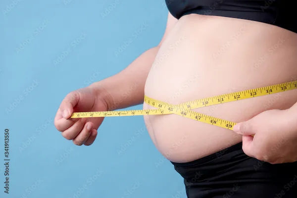 Understanding Obesity Causes, Symptoms and Treatment