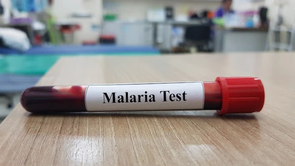 malaria antigen test