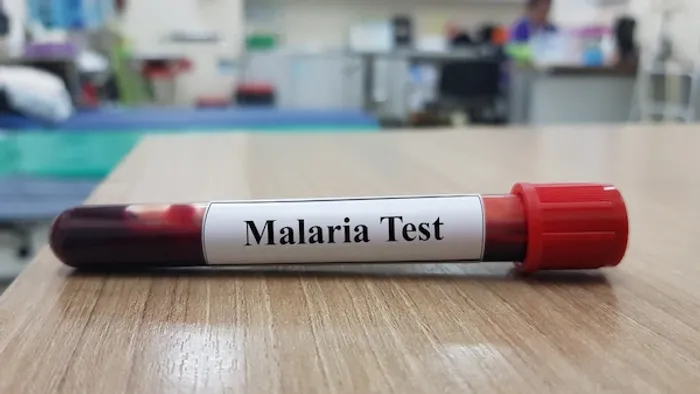malaria antigen test