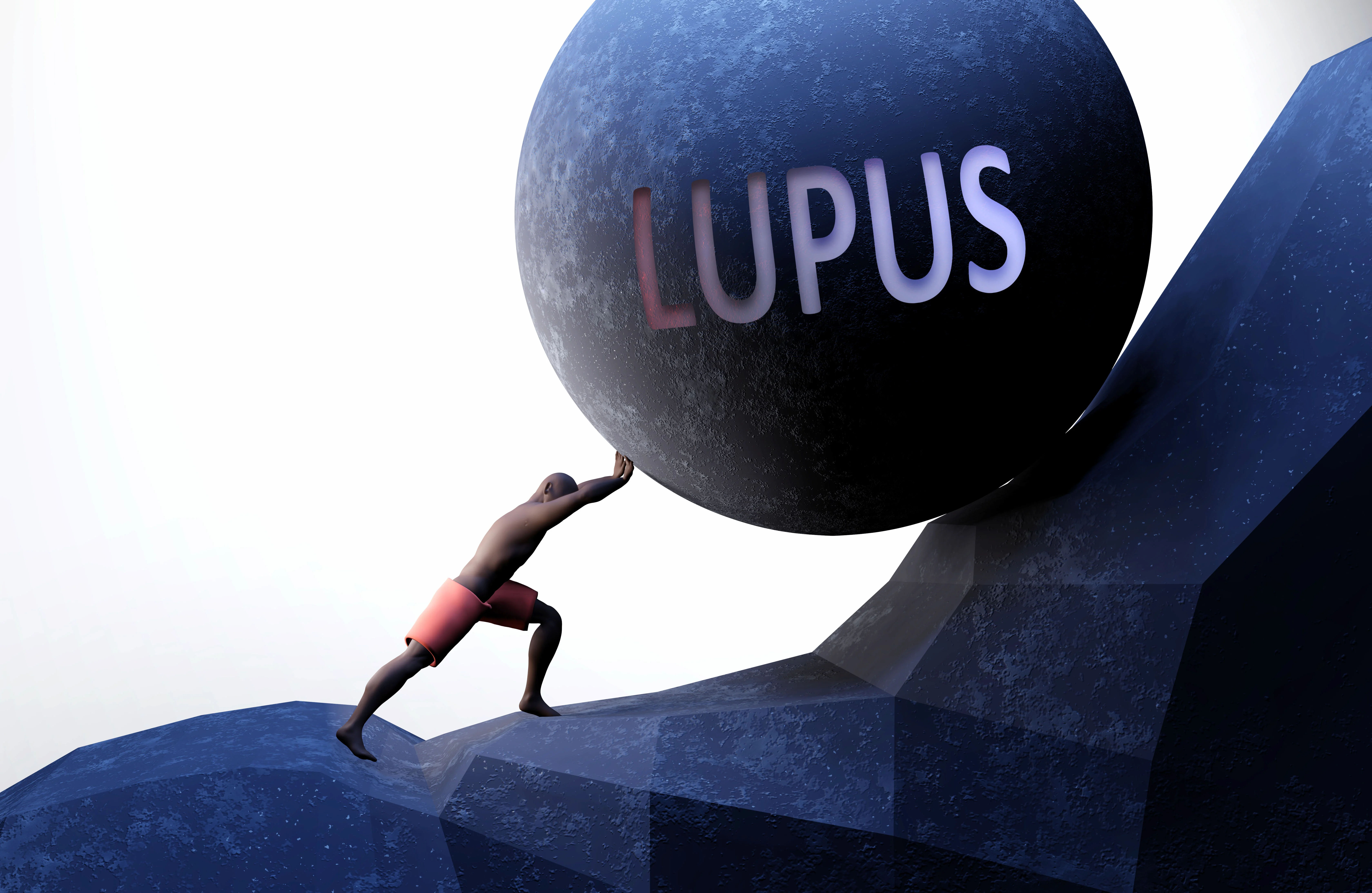 What Leads To Signs Of Lupus Diagnosis Treatment
