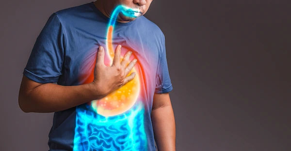The Ultimate Guide to Acid Reflux, Heartburn, and GERD: Symptoms & Relief
