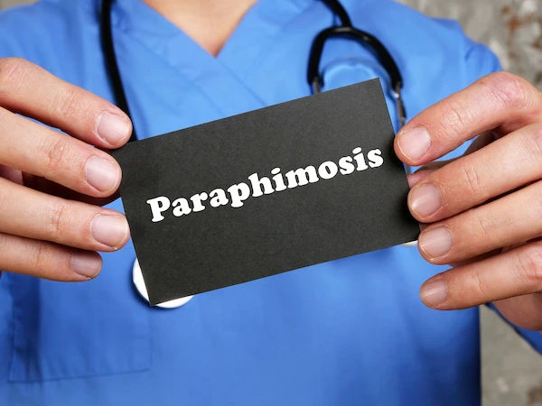 Paraphimosis: Causes, Symptoms, and Urgent Treatment