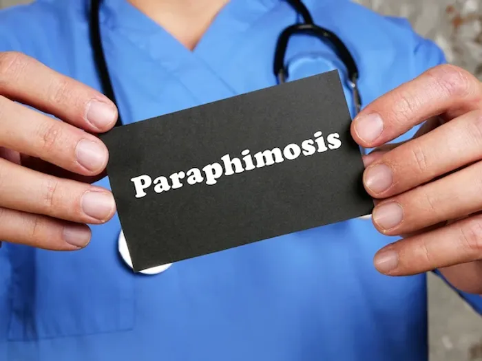Paraphimosis: Causes, Symptoms, and Urgent Treatment