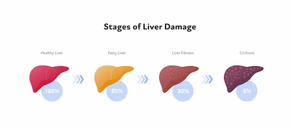 Marching Towards Healthy Liver Signs And Of Liver Damage