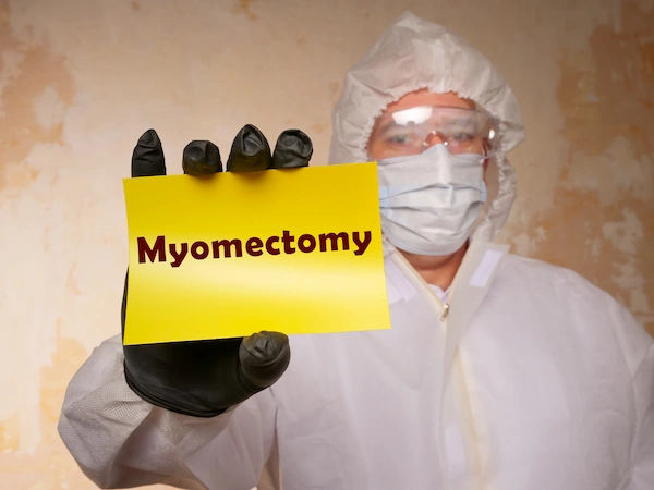 Myomectomy