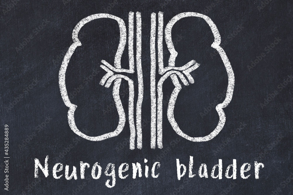 Understanding Neurogenic Bladder
