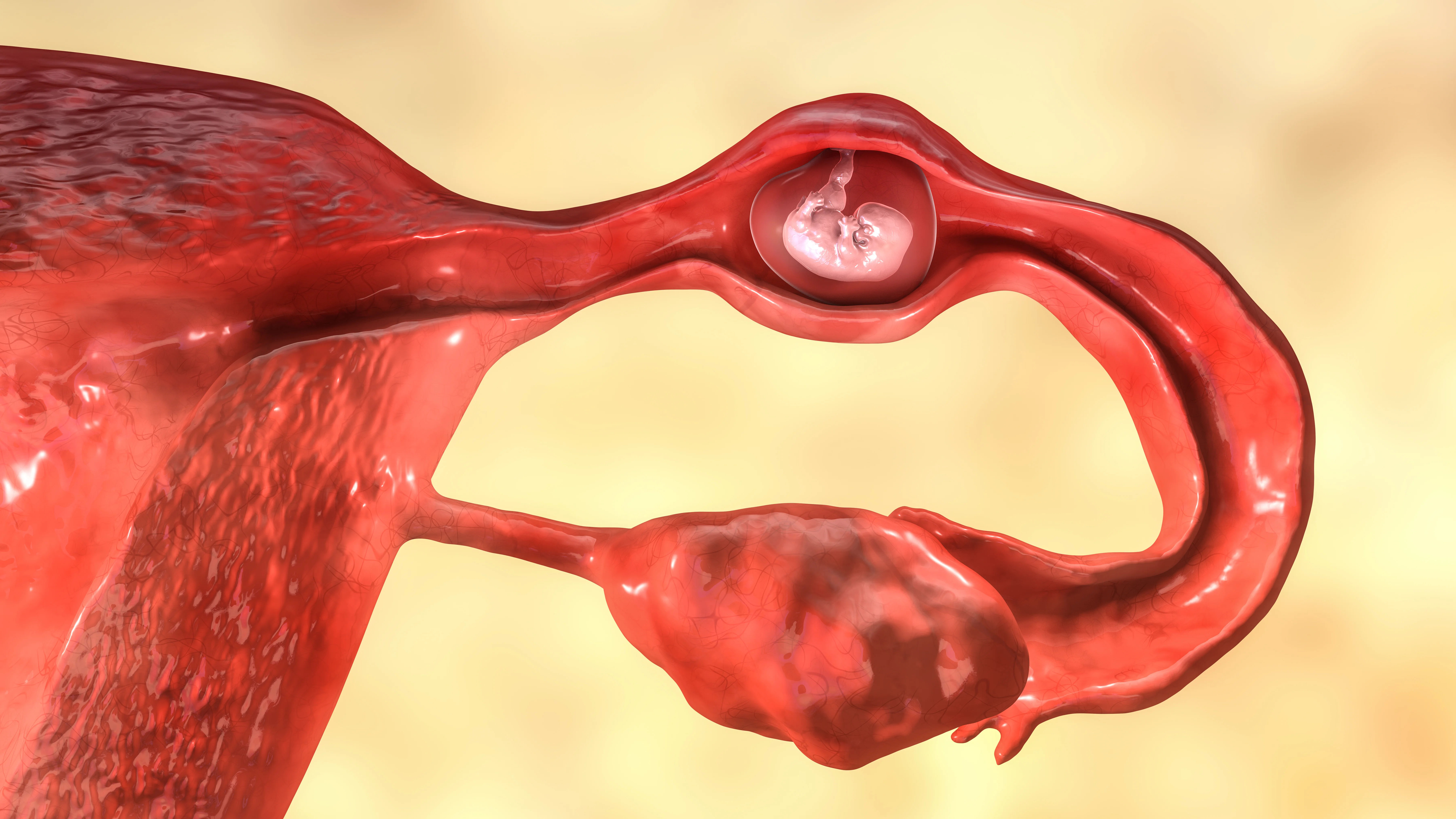 Ectopic Pregnancy: Symptoms, Causes, and Emergency Care