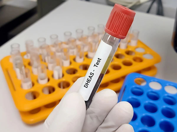 dheas test