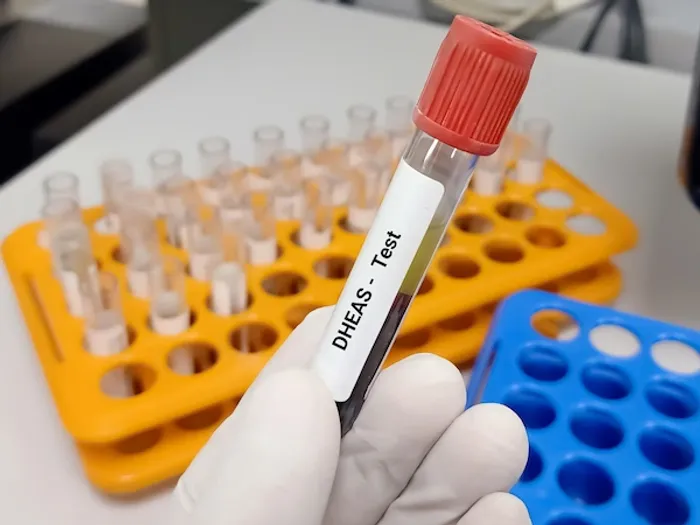 dheas test