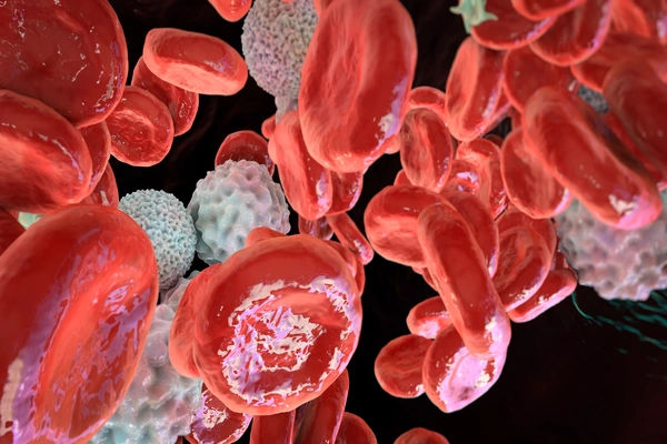 polycythemia vera