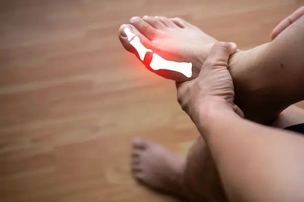 Gout