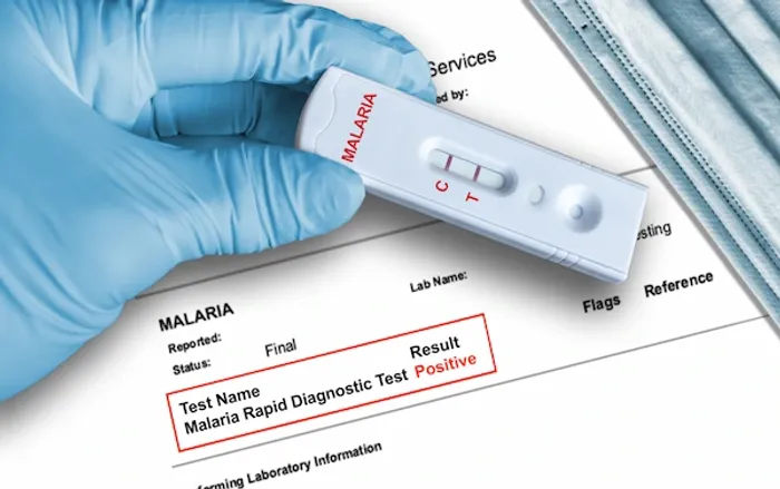malaria antigen test