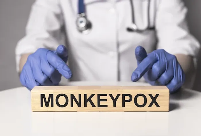 Monkeypox Symptoms, Causes, Treatment and Prevention