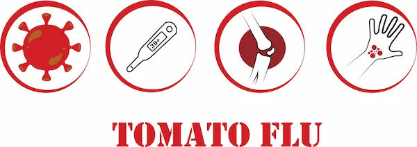 Guide to Tomato Flu
