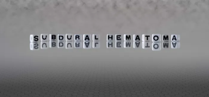 subdural hematoma