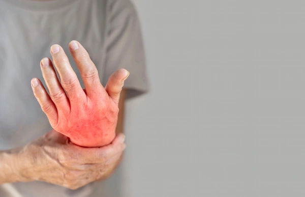 Arthritis Diagnosed