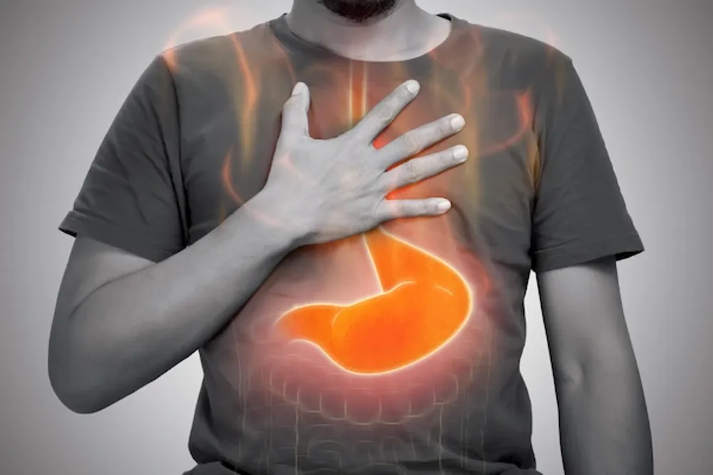 Understanding GERD: Symptoms, Causes, and Effective Relief