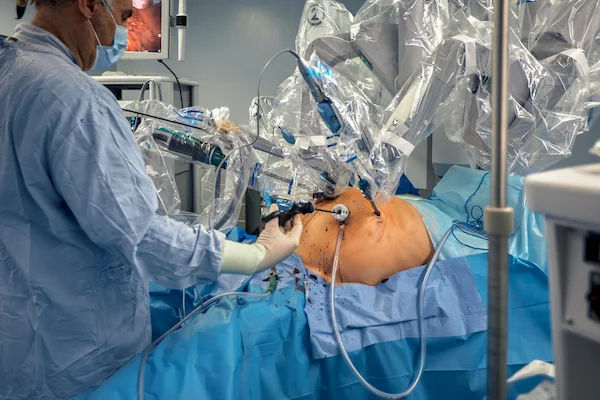 bariatric surgery