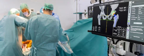 Guide to Robotic Knee Hip Replacement