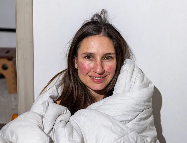 What Leads to Rosacea? Uncovering the Triggers and Root Causes