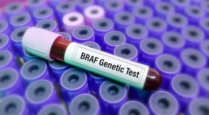 BRAF Testing for Melanoma Overview