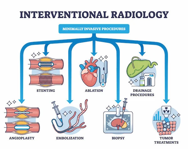 Interventional Radiology: Your Guide to Minimally Invasive Healing