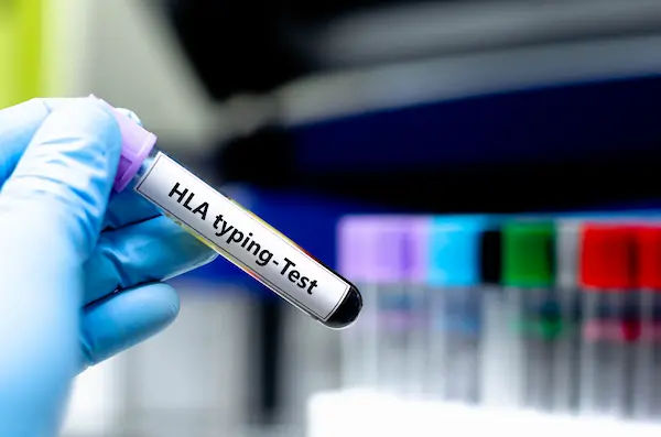 NextGen HLA Typing in Organ Transplantation