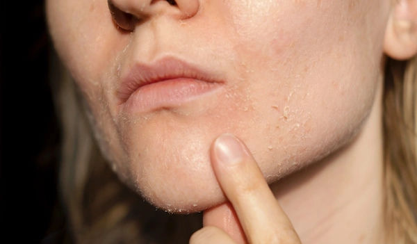 Skin Care Routine for Dry Skin