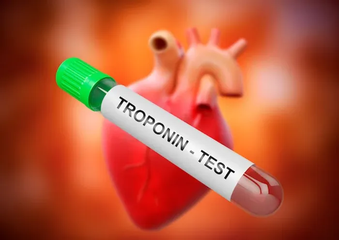 Understanding the Troponin Test and Normal Ranges