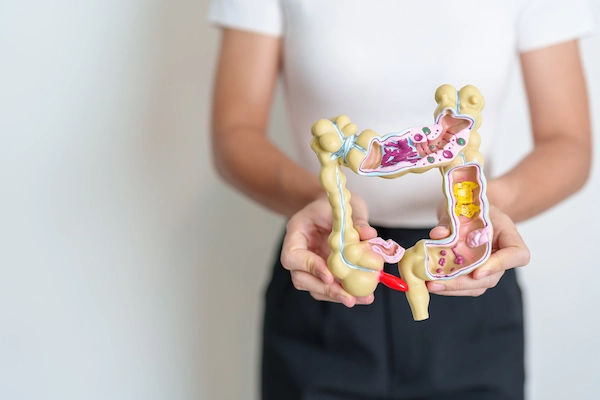 irritable-bowel-syndrome