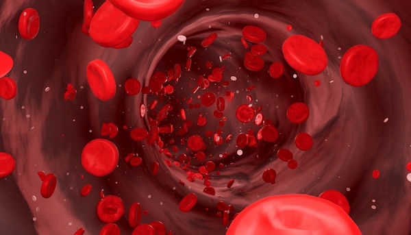 Blood Clots