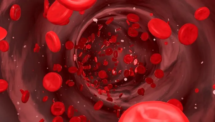 Blood Clots
