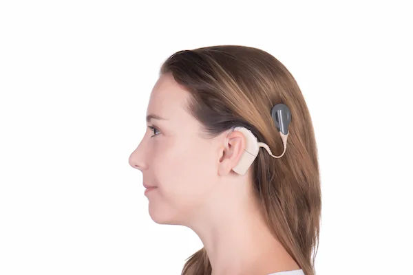 Guide to Cochlear Implant
