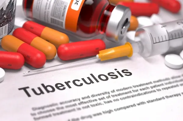 tuberculosis