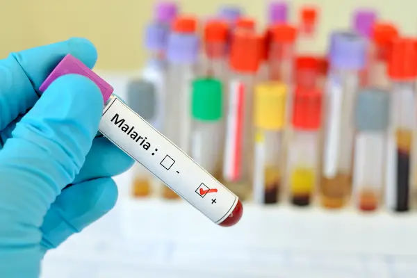 Malaria