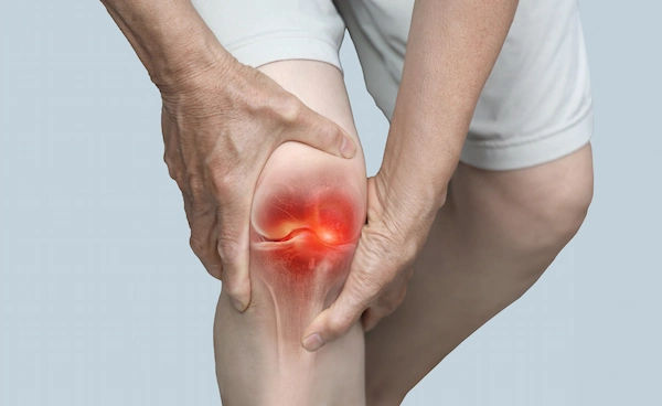 knee osteoarthritis