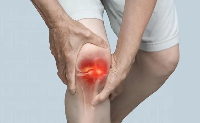 knee osteoarthritis