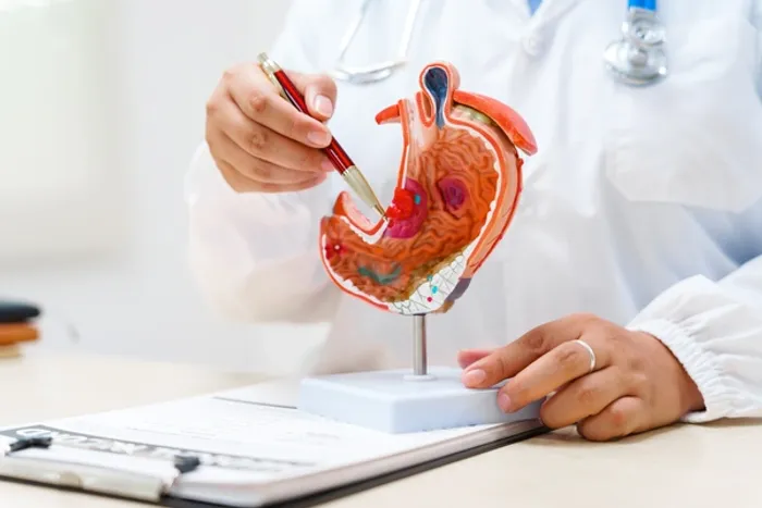 stomach cancer