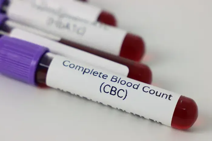 Complete Blood Count Cbc Test
