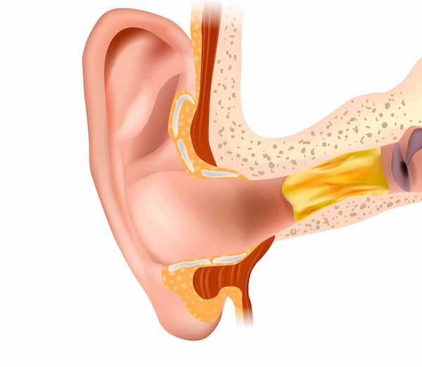ear wax